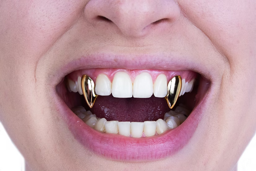 Close-up of a person's mouth wearing two gold vampire fang tooth grills on the front teeth.