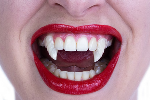 Close-up of a person's mouth wearing a pair of vampire fangs, with bright red lipstick and white teeth visible against a white background.