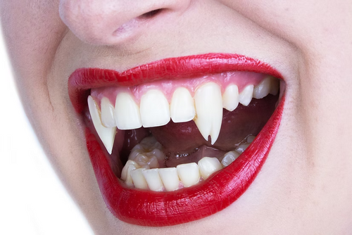 Close-up of a person's mouth with bright red lipstick, showing pointed vampire-style fangs and natural teeth against a white background.