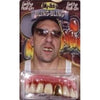 Bling Bling Teeth -Billy Bob Teeth