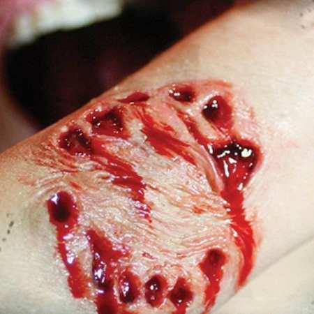 teeth and bite mark