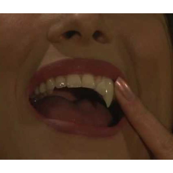 Alpha One Thermoplastic Form Fit Fang and Refill Kit