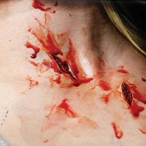 wound prosthetic