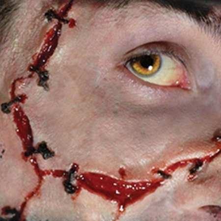 medical stitches effect